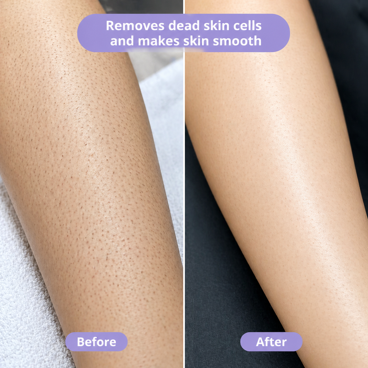 Deji Crystal  Hair Remover