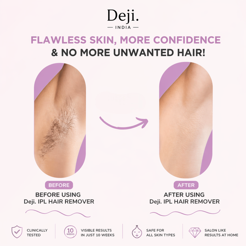 DEJI ADVANCED IPL HAIR REMOVAL DEVICE – SALON SMOOTH SKIN AT HOME